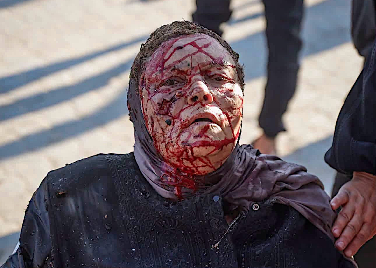 Gaza port, Tuesday, August 18, 2026 – The Gaza Strip
