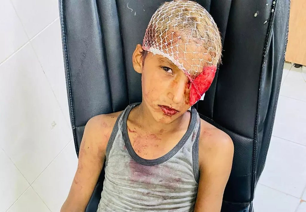 Tuesday, July 2, 2024 – The Gaza Strip inline image