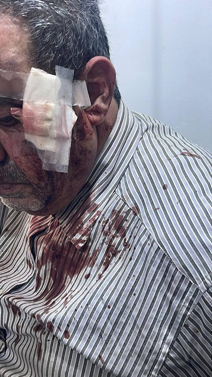 Saturday, October 5, 2024 – The West Bank inline image