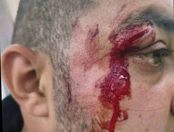 Monday, February 3, 2025 – The West Bank inline image