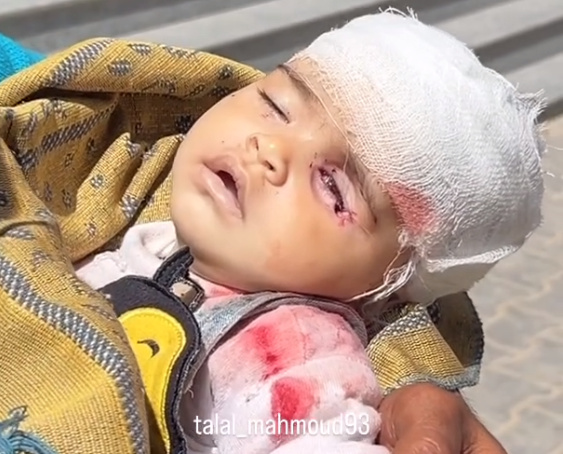 Monday, March 24, 2025 – The Gaza Strip inline image