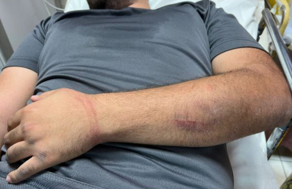 Friday, October 17, 2025 – The West Bank inline image
