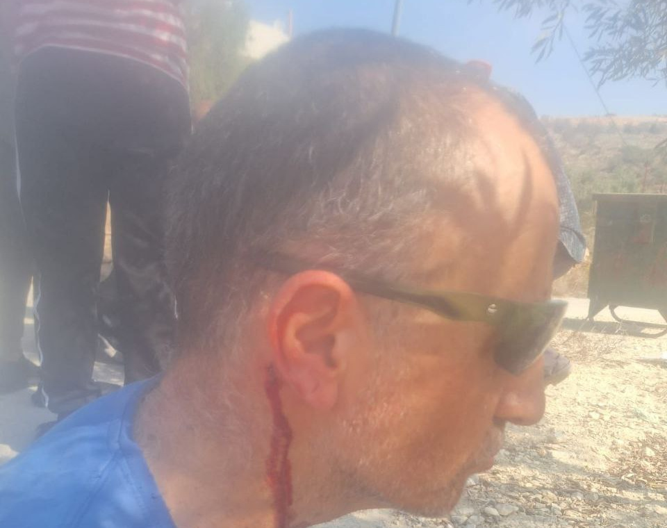 Saturday, November 8, 2025 – The West Bank inline image
