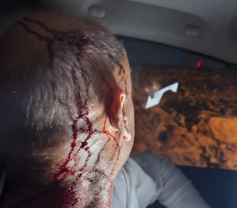 Monday, October 6, 2025 – The West Bank inline image