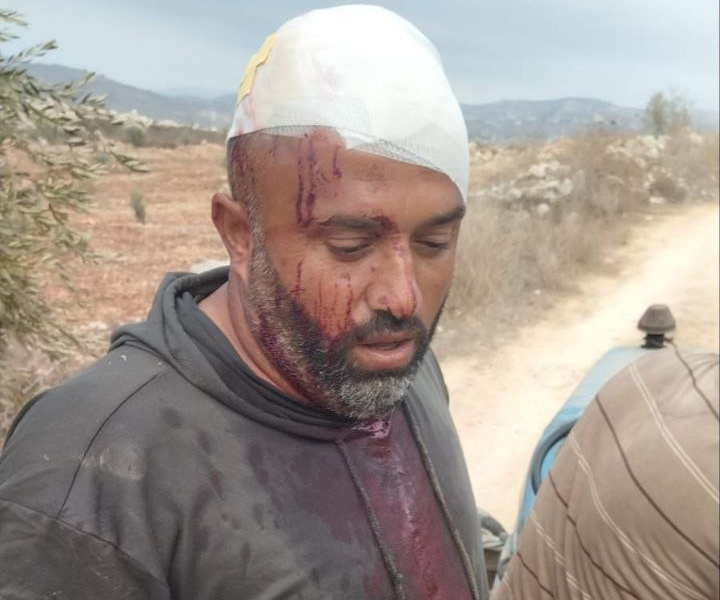 Tuesday, November 11, 2025 – The West Bank inline image