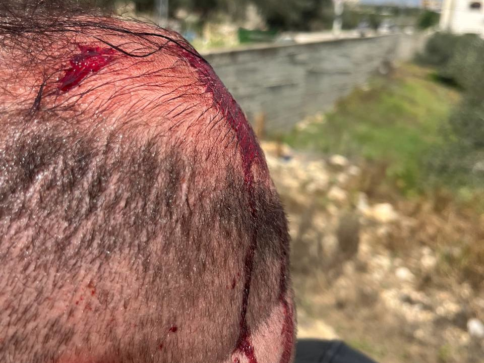 Thursday, March 26, 2026 - The West Bank inline image