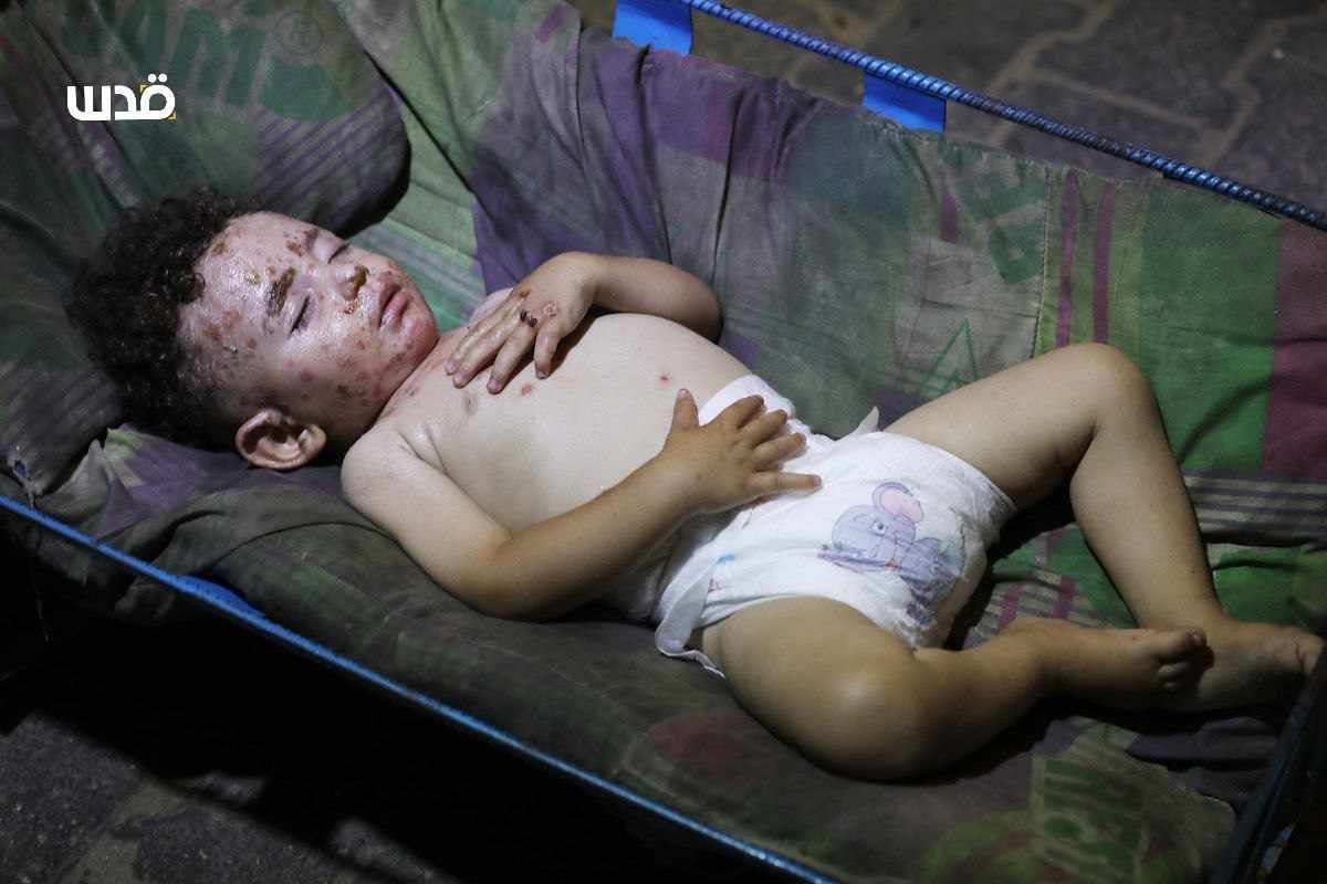 Monday, July 15, 2024 – The Gaza Strip inline image