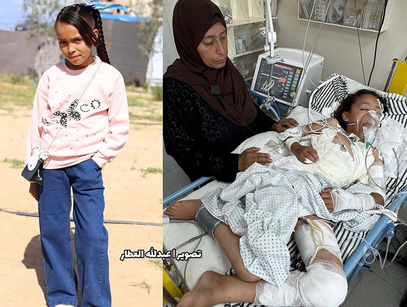 Sunday, July 6, 2025 – The Gaza Strip inline image