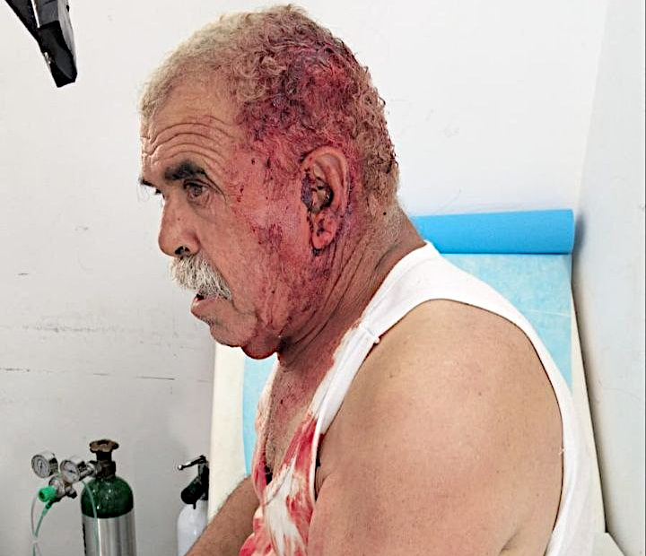 Friday, July 3, 2026 – The West Bank inline image