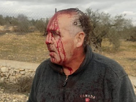 Saturday, December 28, 2024 – The West Bank cover image