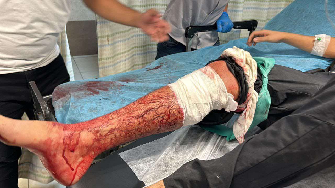 Wednesday, July 31, 2024 – The West Bank inline image