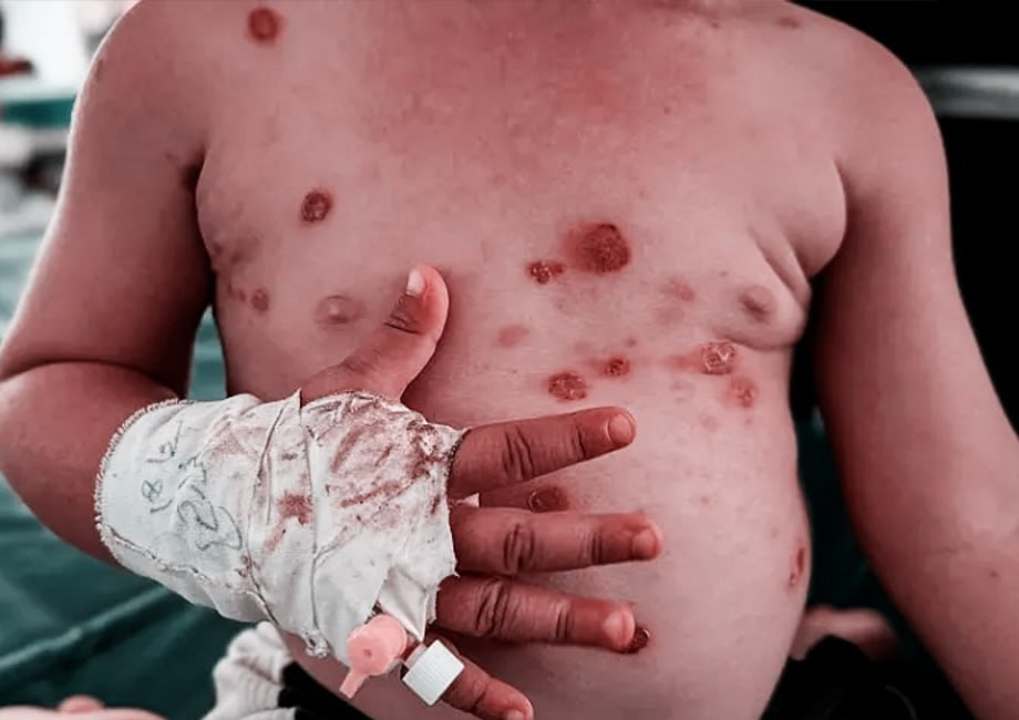 Wednesday, July 8, 2026 – The Gaza Strip inline image