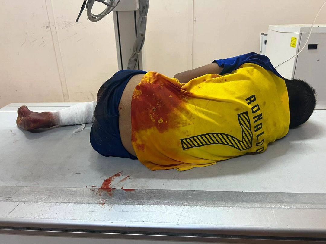 Sunday, August 18, 2024 – The Gaza Strip inline image