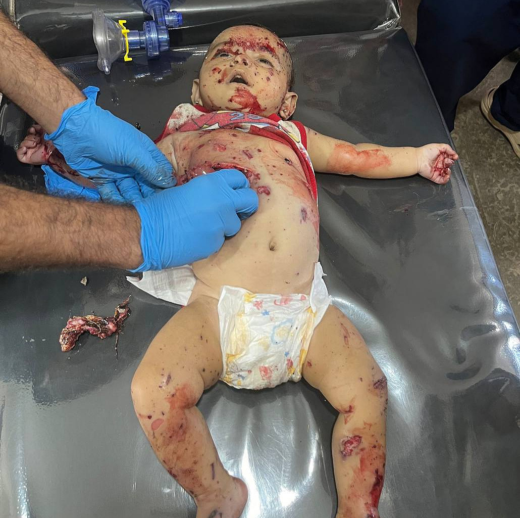 Sunday, July 28, 2024 – The Gaza Strip inline image
