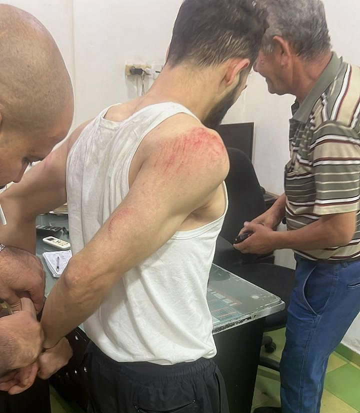 Monday, July 29, 2024 – The West Bank inline image